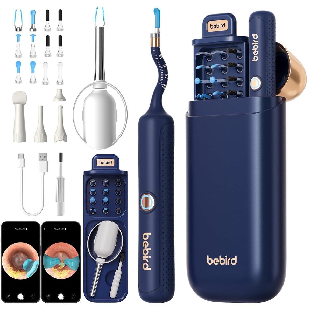 Test Bebird otoscope iScope : caméra oreille HD polyvalente